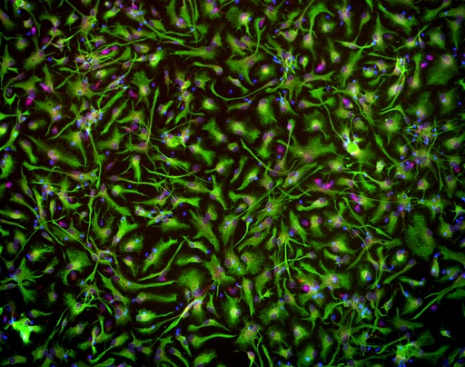 [25sk123] Cortical Astrocytes