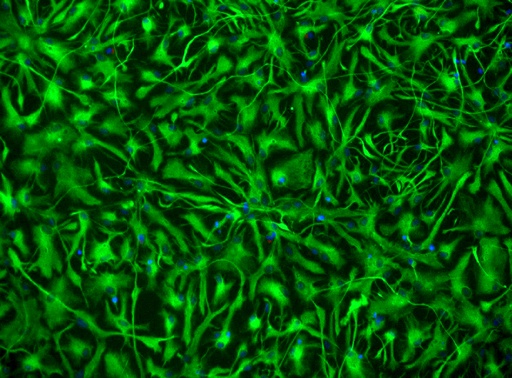 [25sk132] Spinal Astrocytes