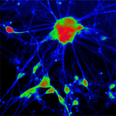 [26sk143] Reporter Cells (Spinal Motor Neurons)