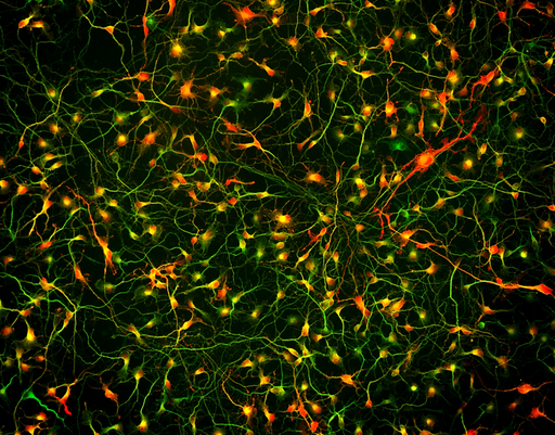 [26sk164] BrainFast Neuronal Maturation Supplement Motor