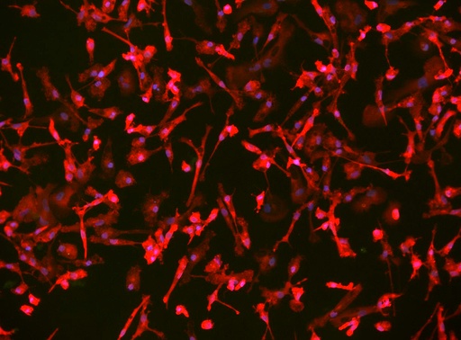 [25sk136] Microglia WC-32